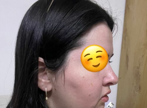 עגילי טניס Zoey photo review